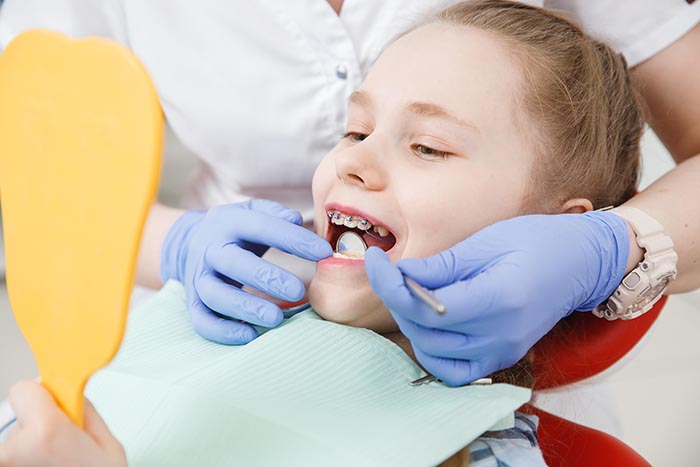 علاج أسنان الاطفال